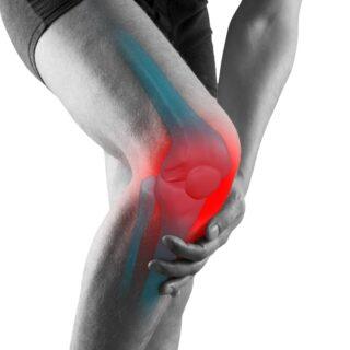 Arthrose – Ursachen, Symptome und Behandlung