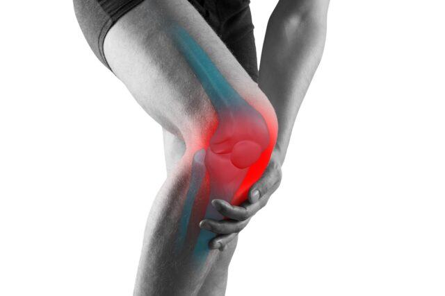 Arthrose – Ursachen, Symptome und Behandlung