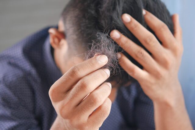 Haarausfall bei Männern - Ursachen und Behandlung