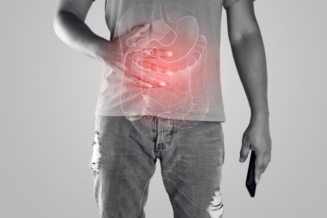 Morbus Crohn - Ursachen, Symptome und Behandlung